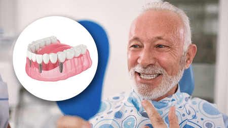 Implant Retained Dentures Plano and Dallas, TX