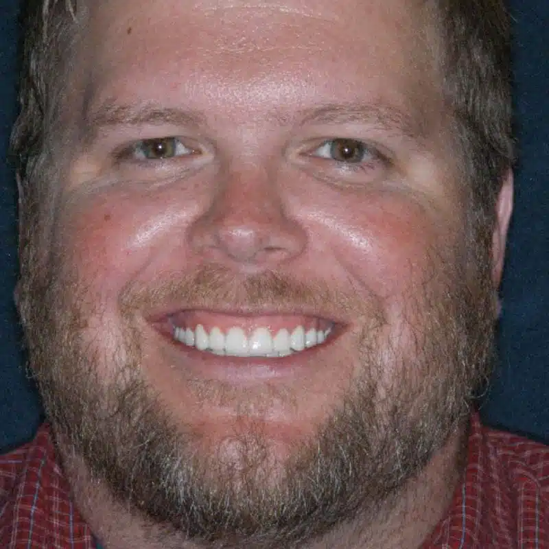 millard