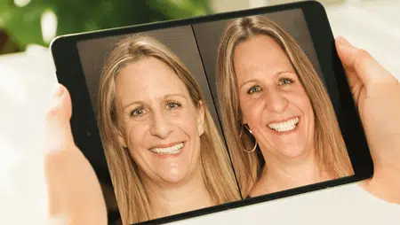Trial smile Plano