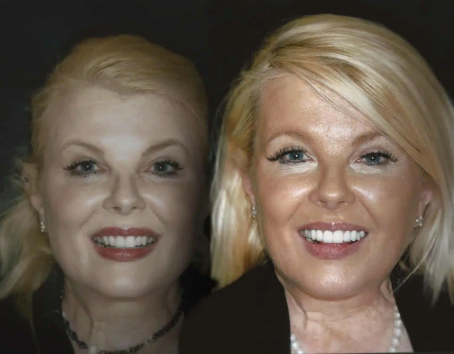 Perfect Smile Dallas TX