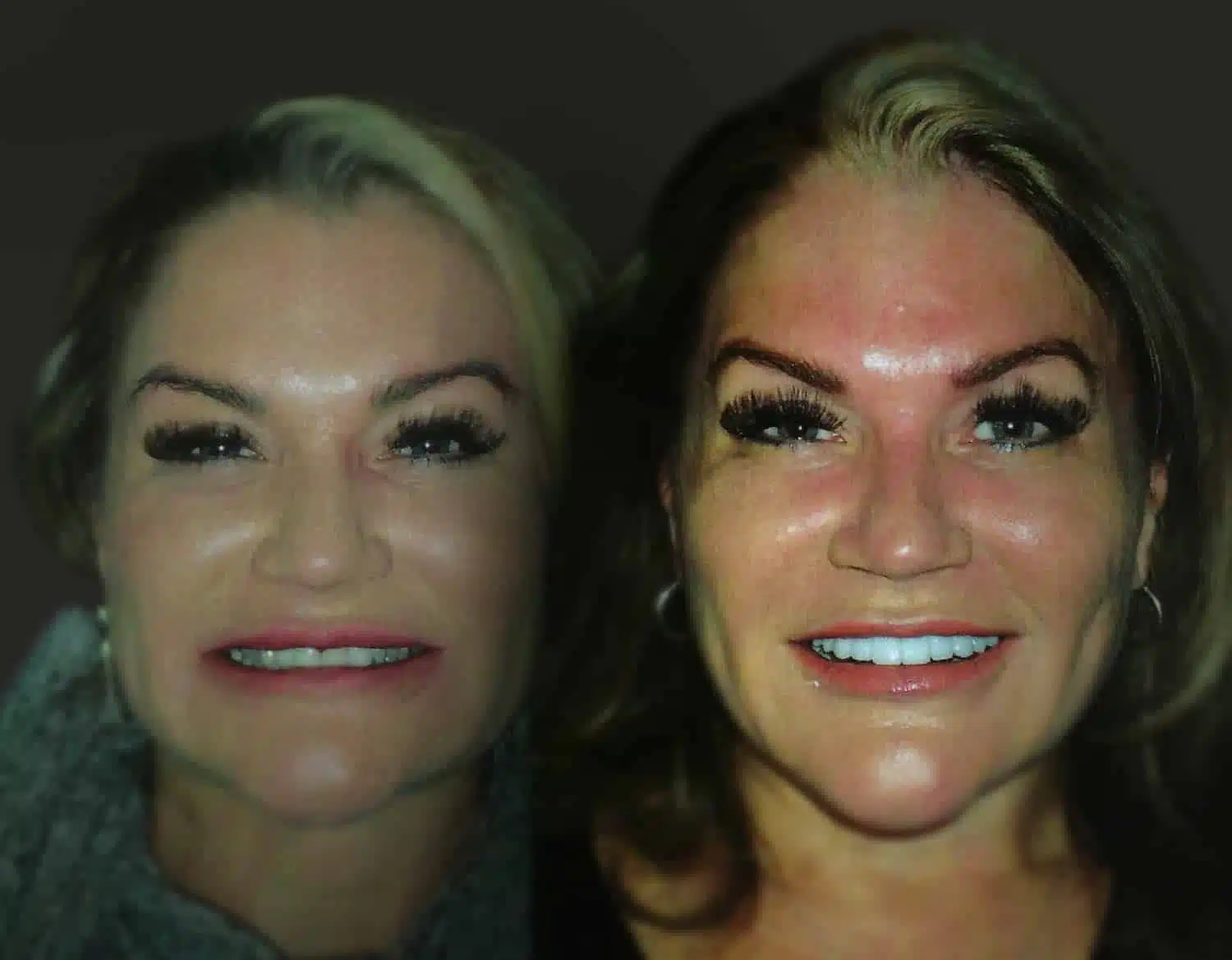 Top Cosmetic Dentist Dallas Fort Worth