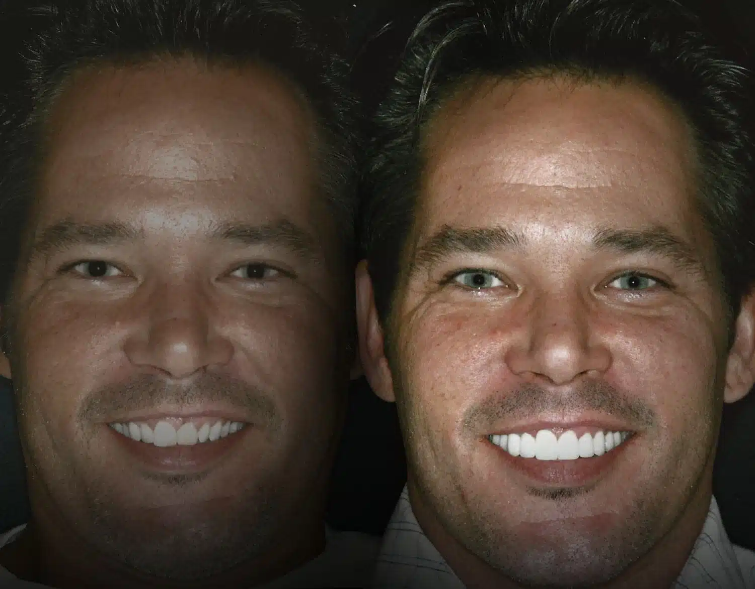 Before and After Gallery - Dallas TX