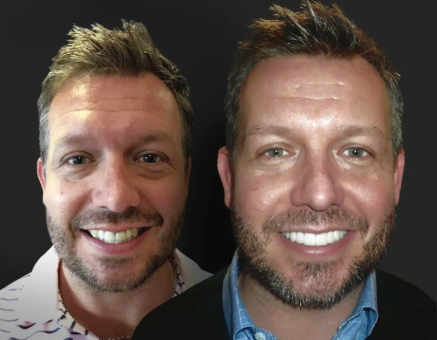 Dallas Dentist Before After Photos