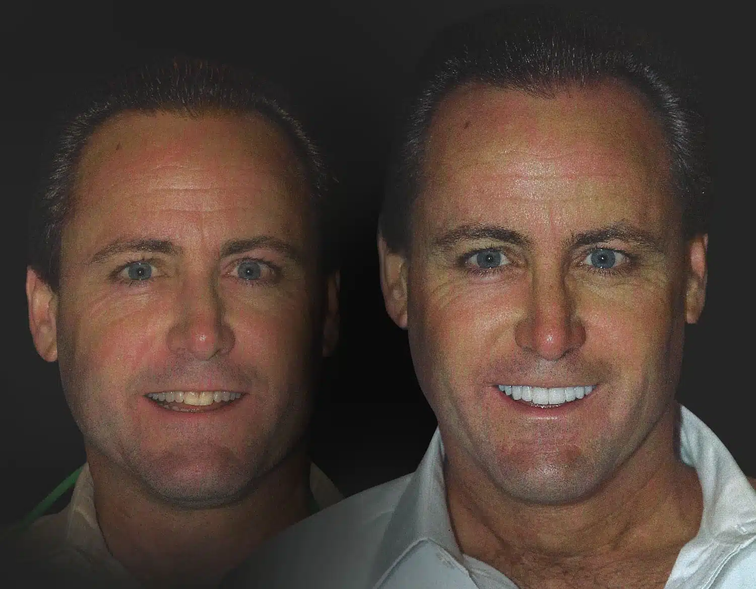 Best Cosmetic Dentist Dallas