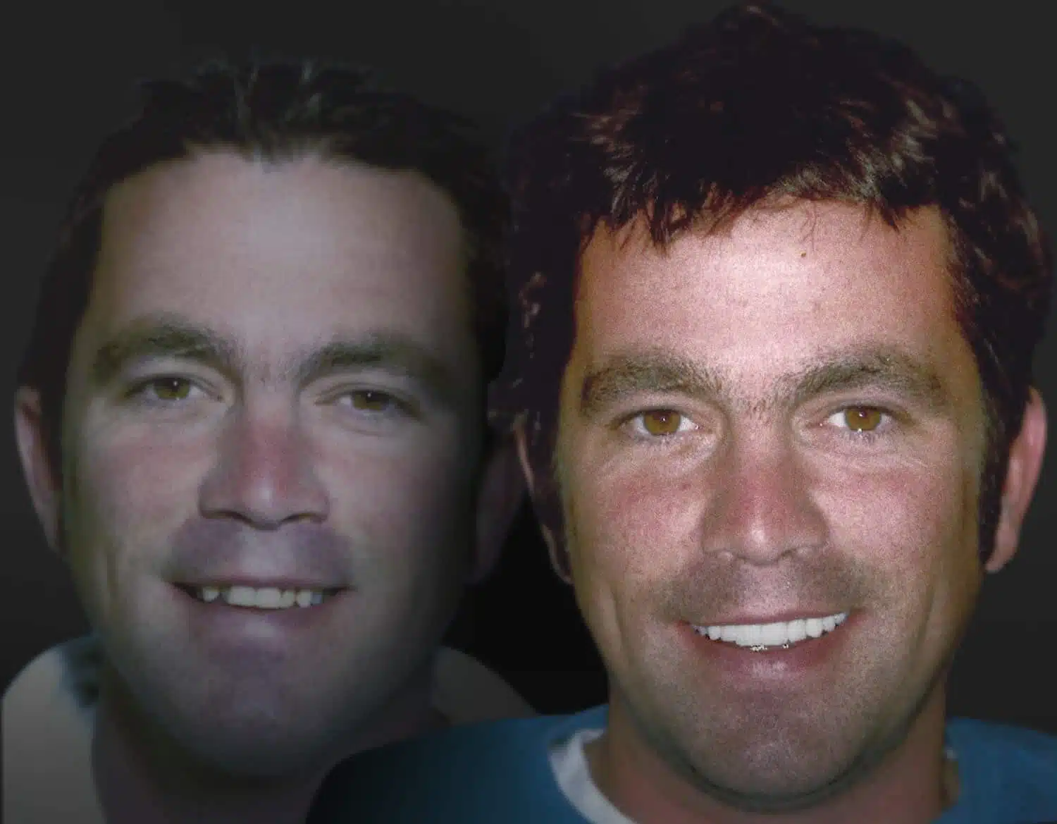 Dental Makeover Dallas TX