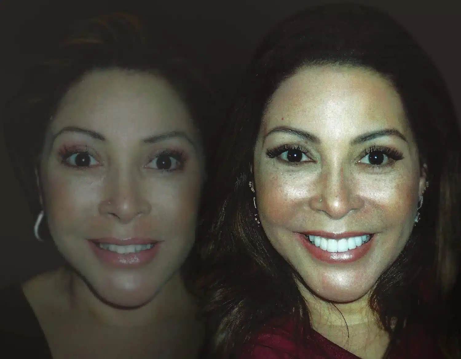 Cosmetic Dentistry Gallery Dallas