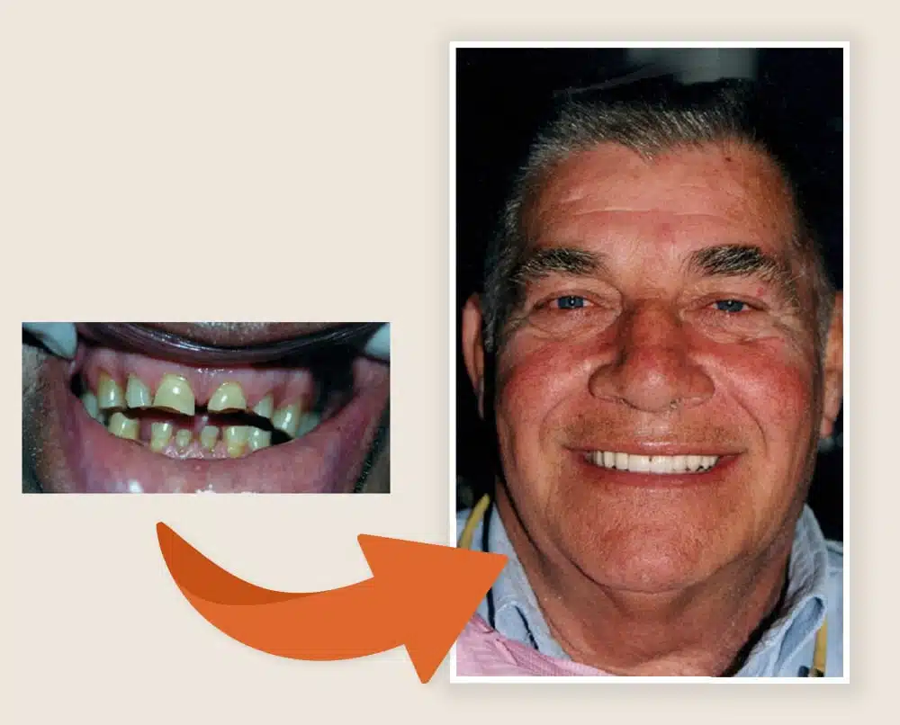 Before After 2