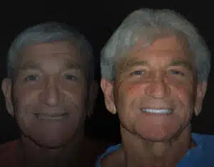 anthony ba 1