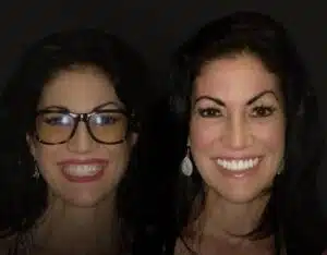 ashley before after
