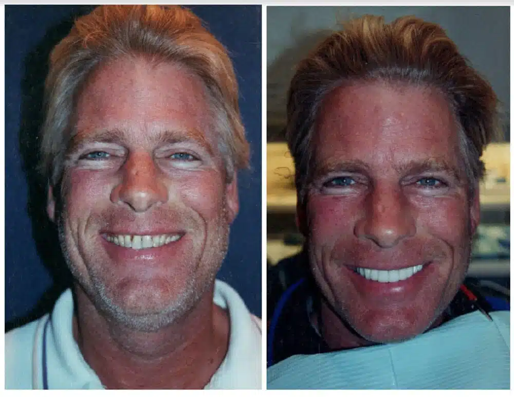 before after 3