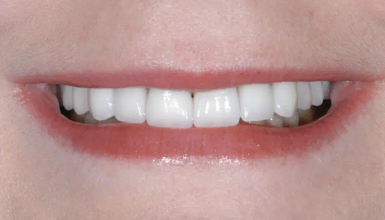 jen after 768x440