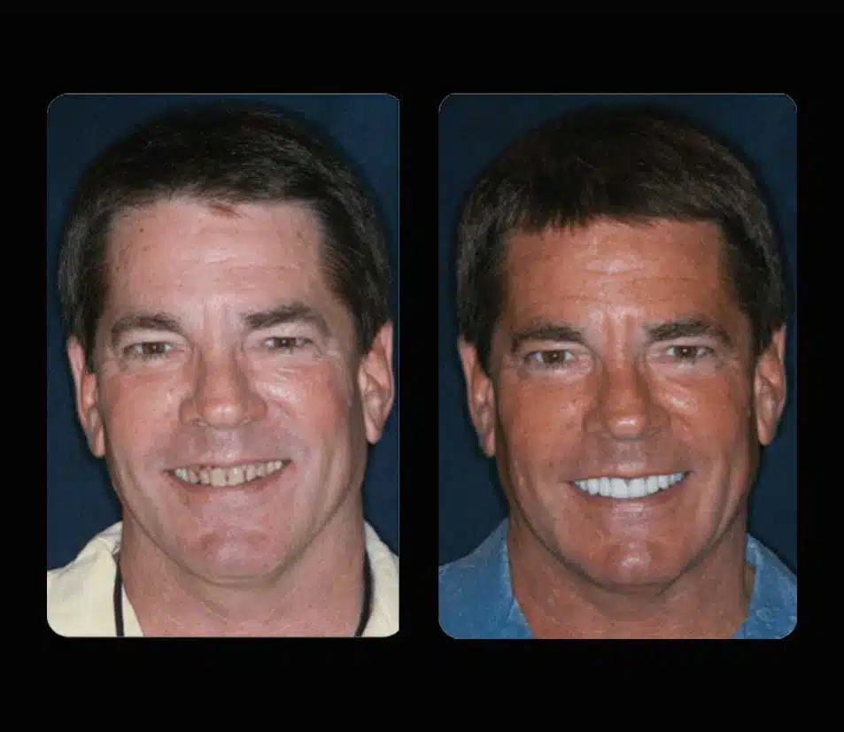 Transform Your Smile, Transform Your Life: The Advantages of Cosmetic Dental Procedures 65e236a6bacfa.jpeg