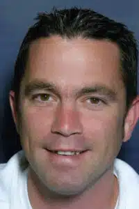Before Image: Smile Makeover