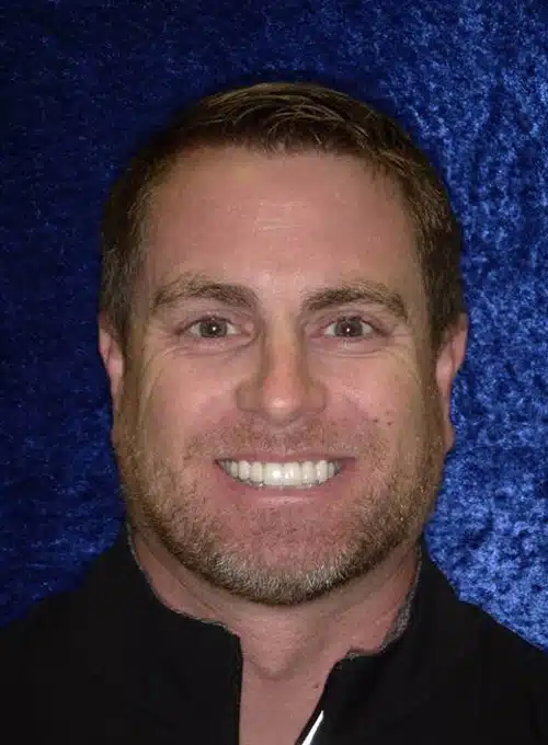 After Image: Smile Makeover - front