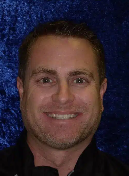 Before Image: Smile Makeover - front