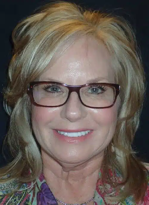 After Image: Smile Makeover - front