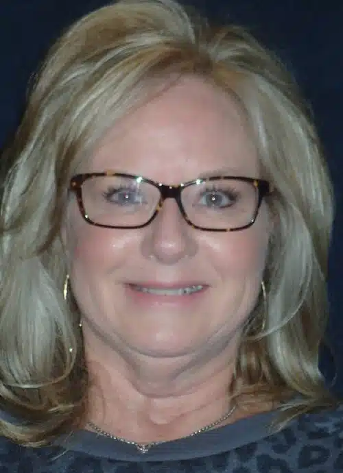 Before Image: Smile Makeover - front