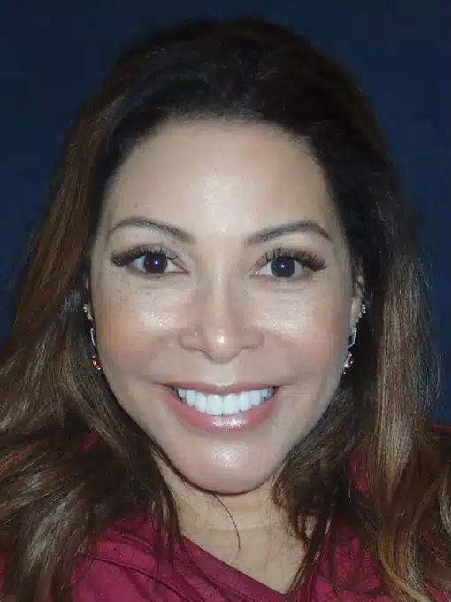 After Image: Smile Makeover - front