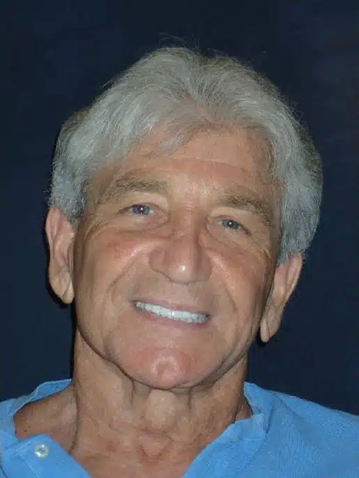 After Image: Smile Makeover - front