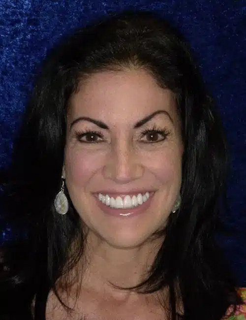 After Image: Smile Makeover - front