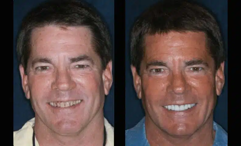 Dental testimonials in Plano, TX