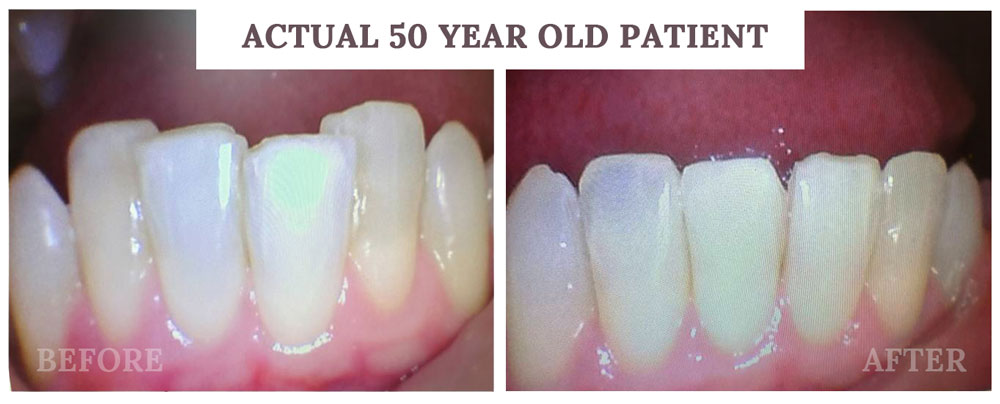 orthodontics at smilemakeroftexas