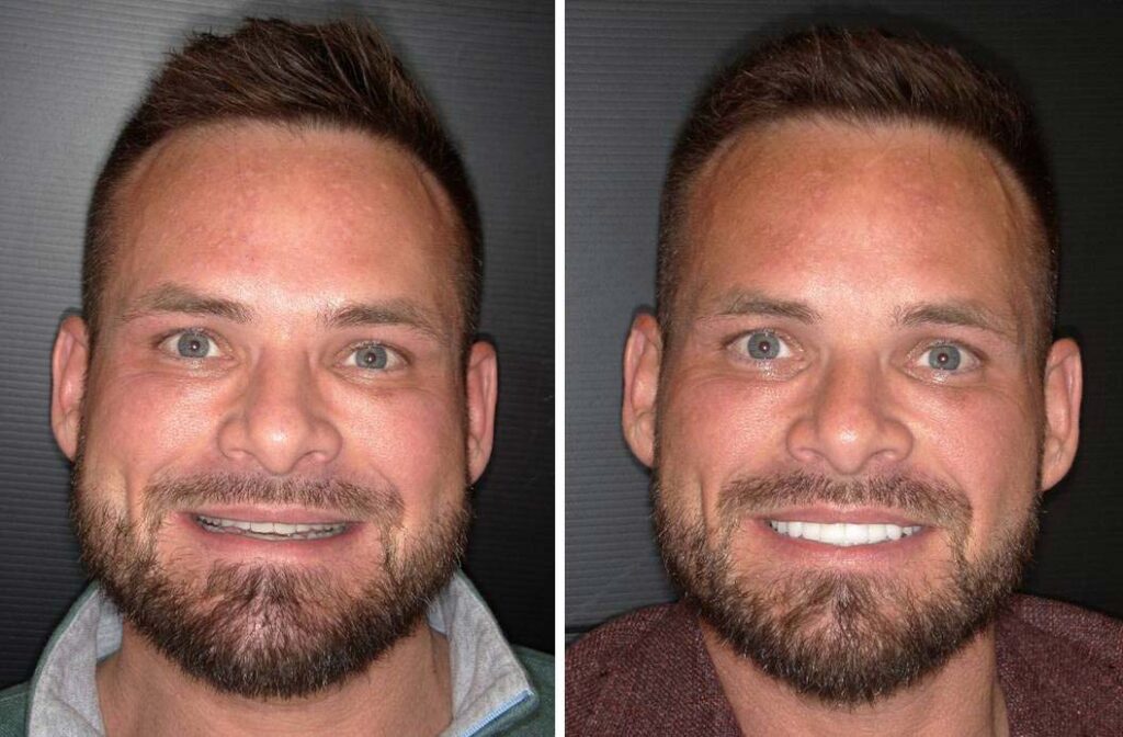 Jason Before and After