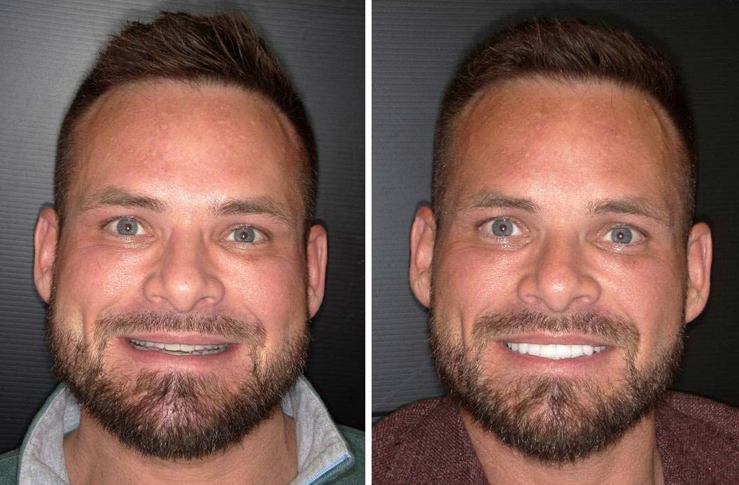 Jason Before and After