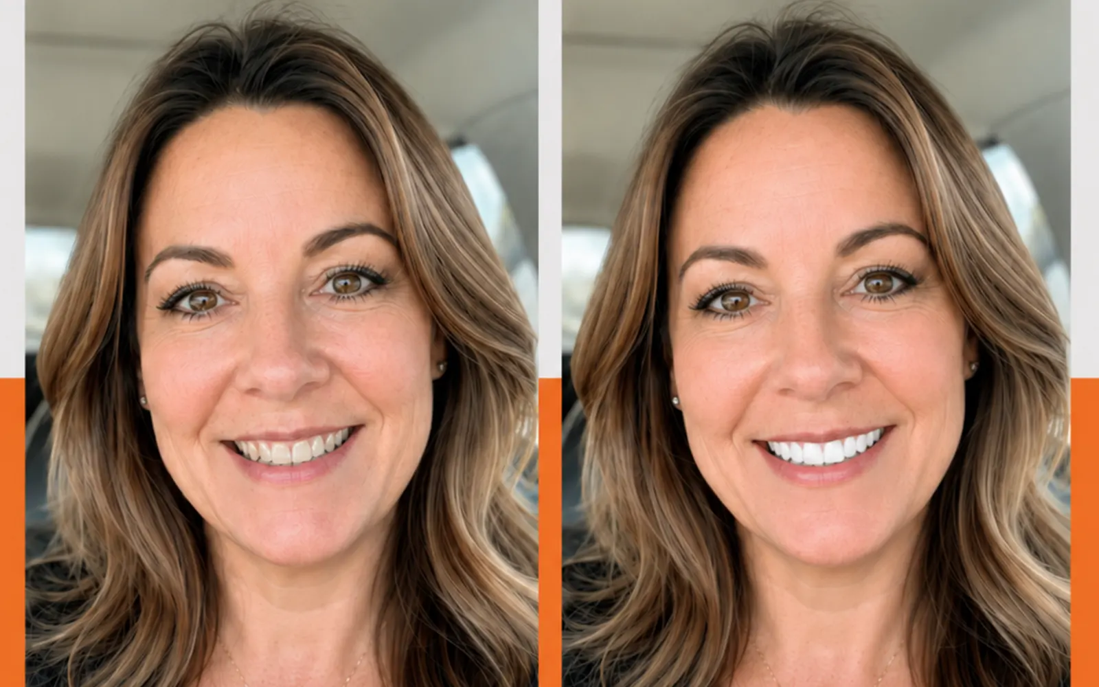 Virtual Trial Smile before and after preview — Smile Maker of Texas, Plano