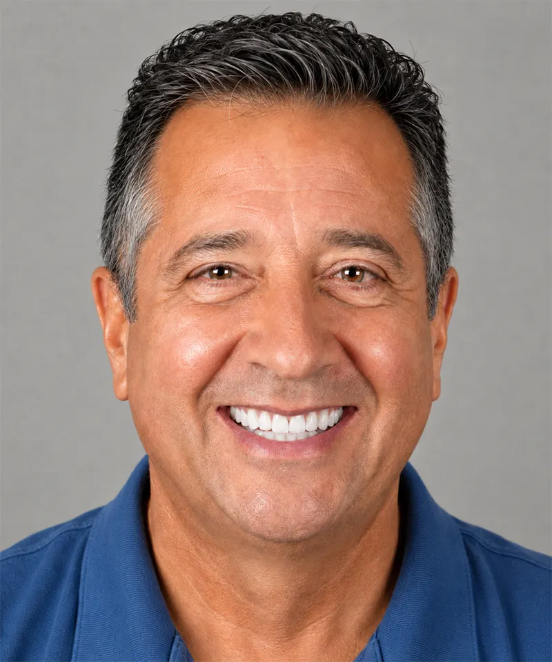 After full SmileLift smile makeover — 10 porcelain veneers, 2 visits, Plano TX