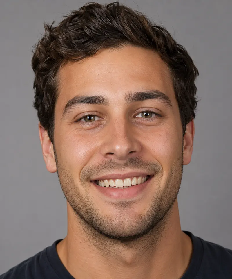 Before teeth whitening and cosmetic bonding — Dallas TX patient