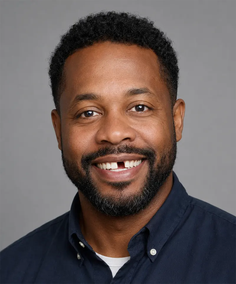 Before dental implant and crown restoration — Allen TX patient