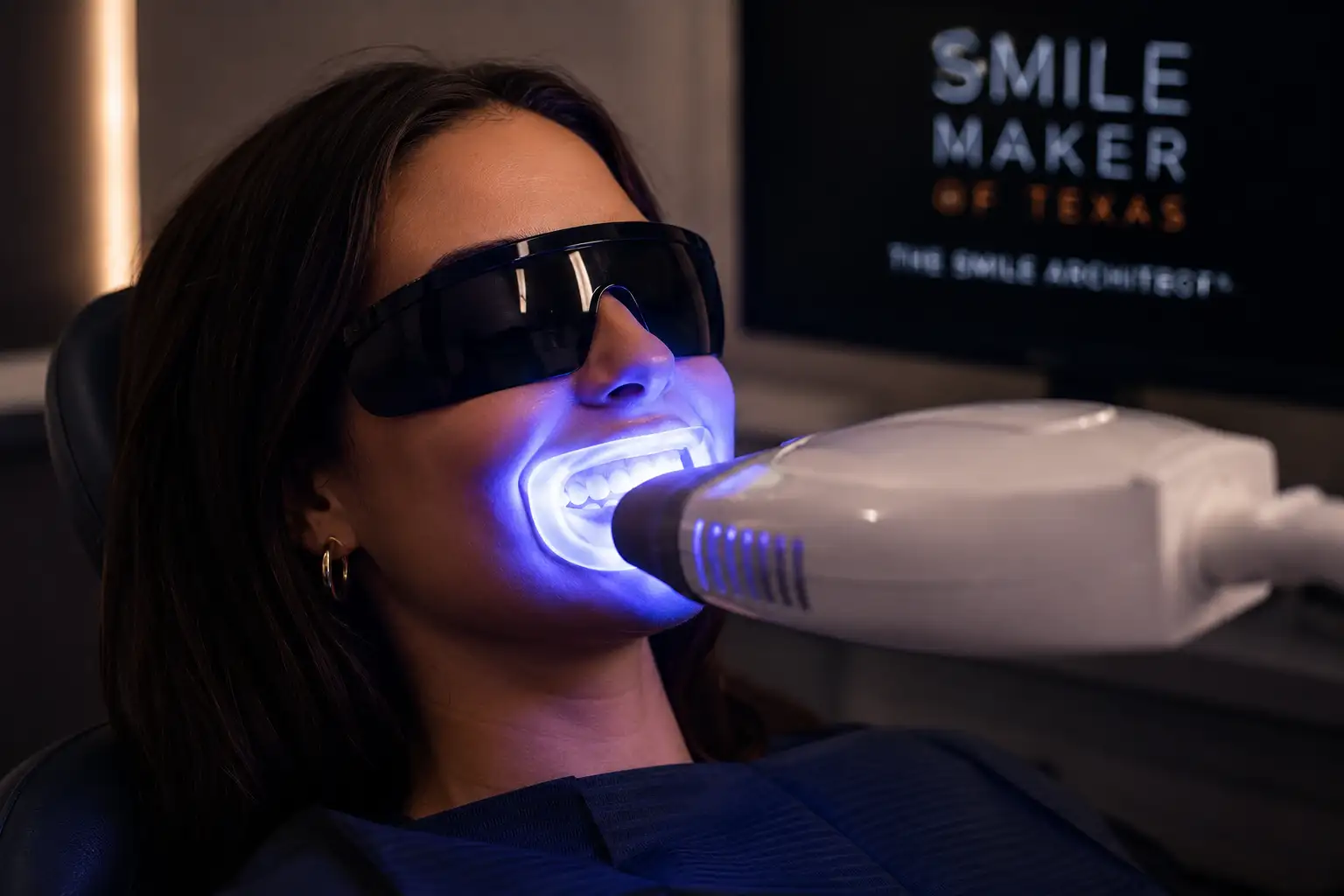 Laser teeth whitening before and after result at Smile Maker of Texas, Plano & Dallas